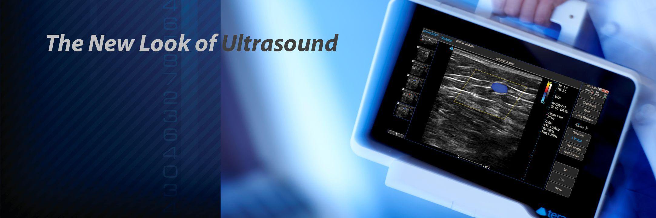 Terason Ultrasound banner