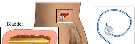CathetersDaily's profile banner image
