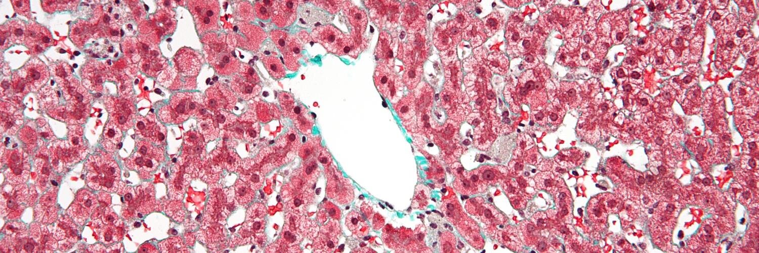 Kevork Peltekian, MD banner