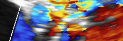 EchoholicsAnon's profile banner image