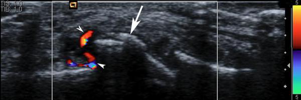 ProfTonyRedmond Profile Banner
