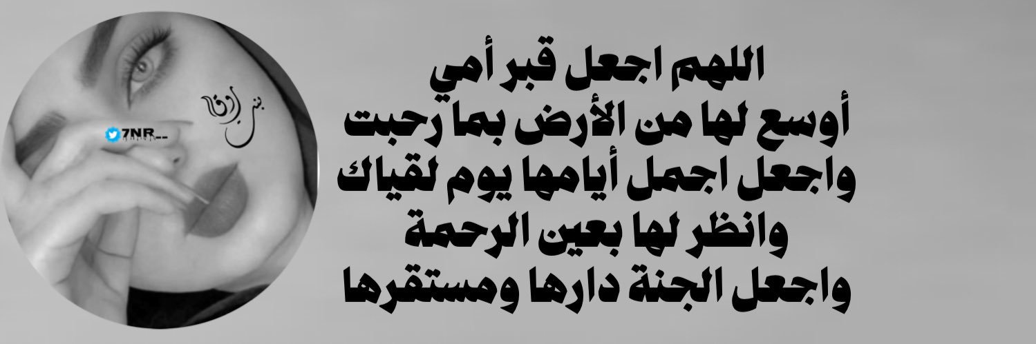 ‏غياب banner