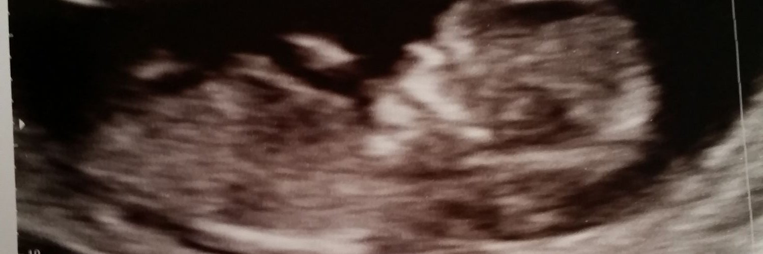 Christopher hill banner