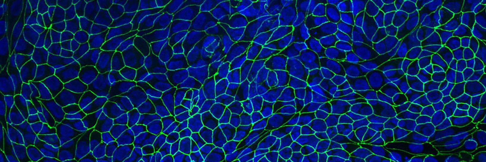 Crit Care Nephrology banner