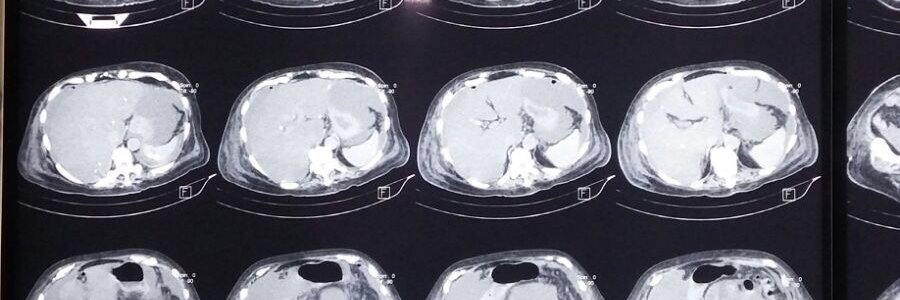 Nahim Barron MD MHSc FACS banner