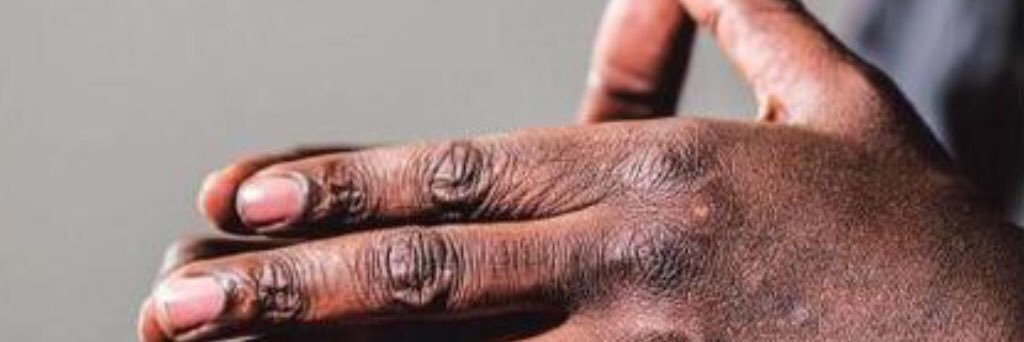 Wouter Van Bellingen (he/him) banner