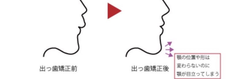 layout_error's profile banner image
