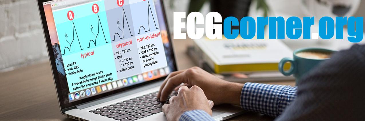 ECGcorner banner