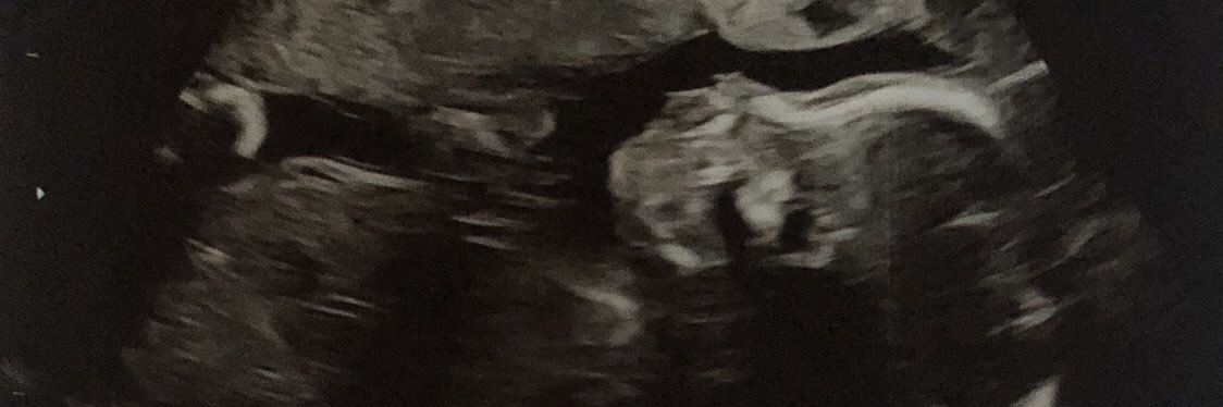 liawilson77's profile banner image