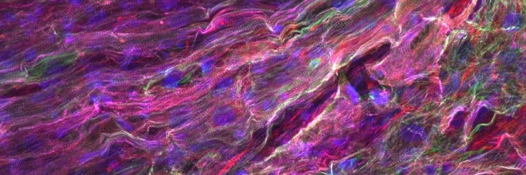 Sharon Fleischer banner