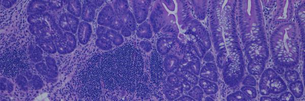 IMMUNOLAB Profile Banner