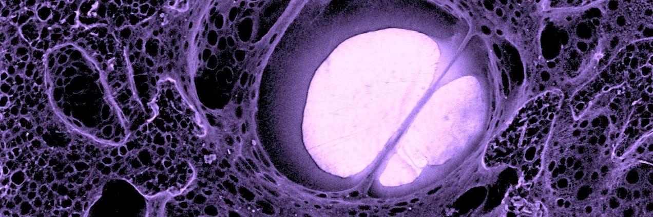 Immodgel Project banner