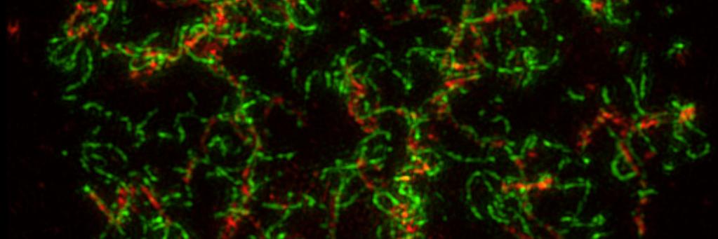 CMS James Hutton banner