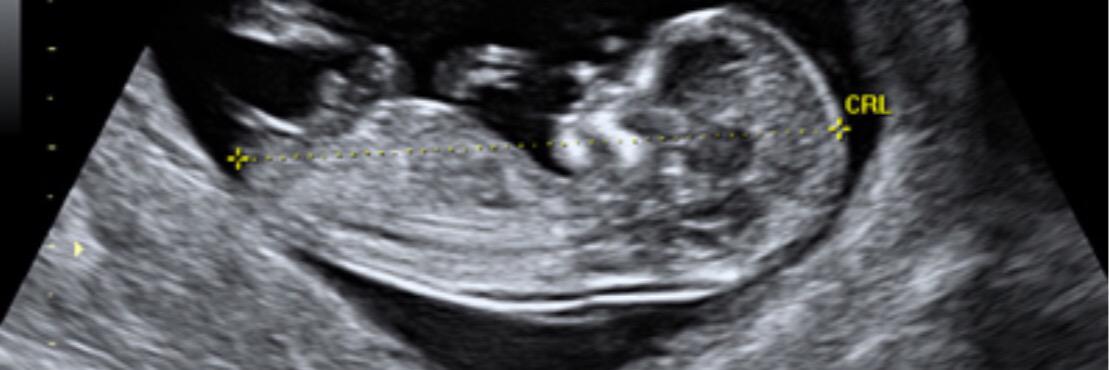 pablooriolroca1's profile banner image