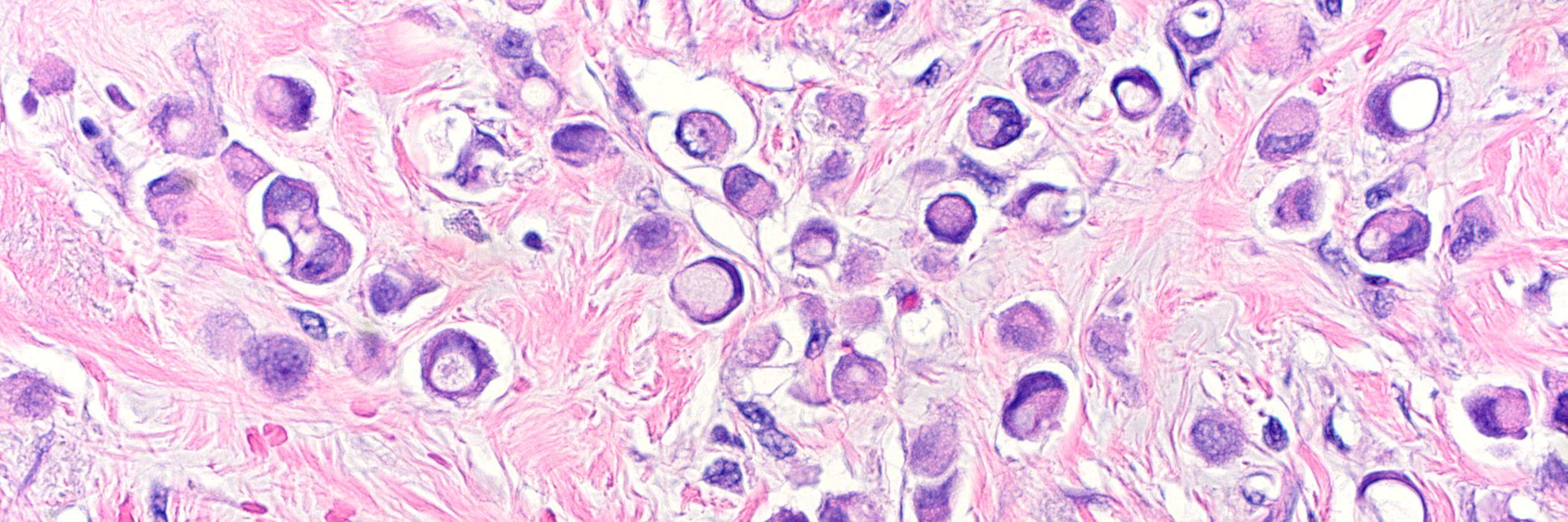 brstpathology's profile banner image