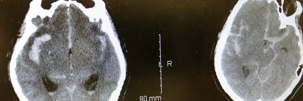 chethanpv Profile Banner