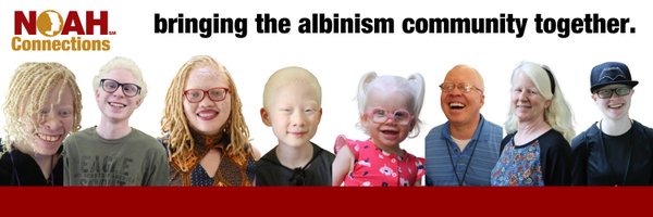 NOAHAlbinism Profile Banner