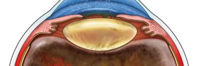 ADNIVawareness's profile banner image