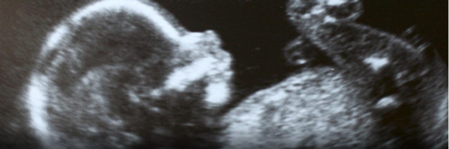 Anne O'Connor banner
