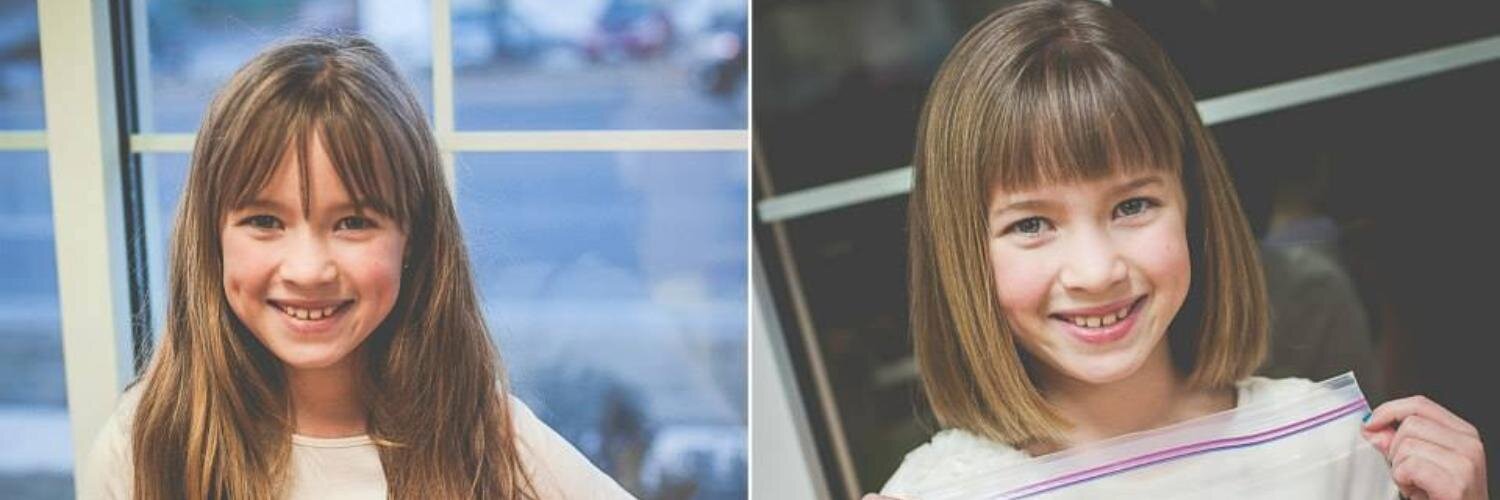 ChildrenwithHairloss banner