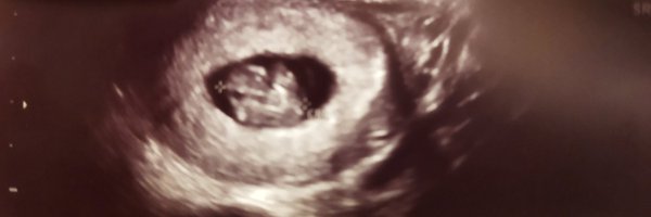 joseF9683 Profile Banner