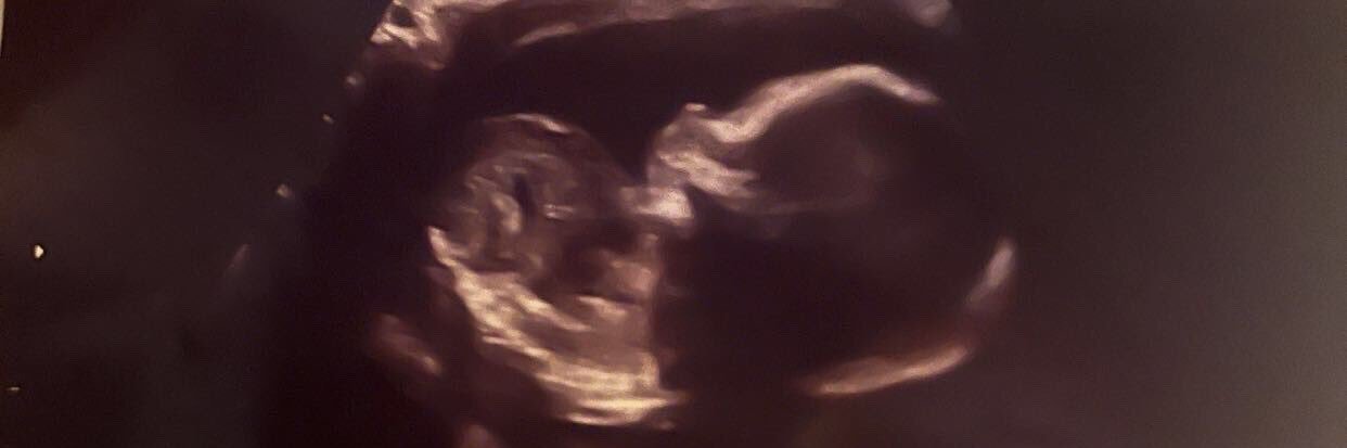 a_mckenzie14's profile banner image