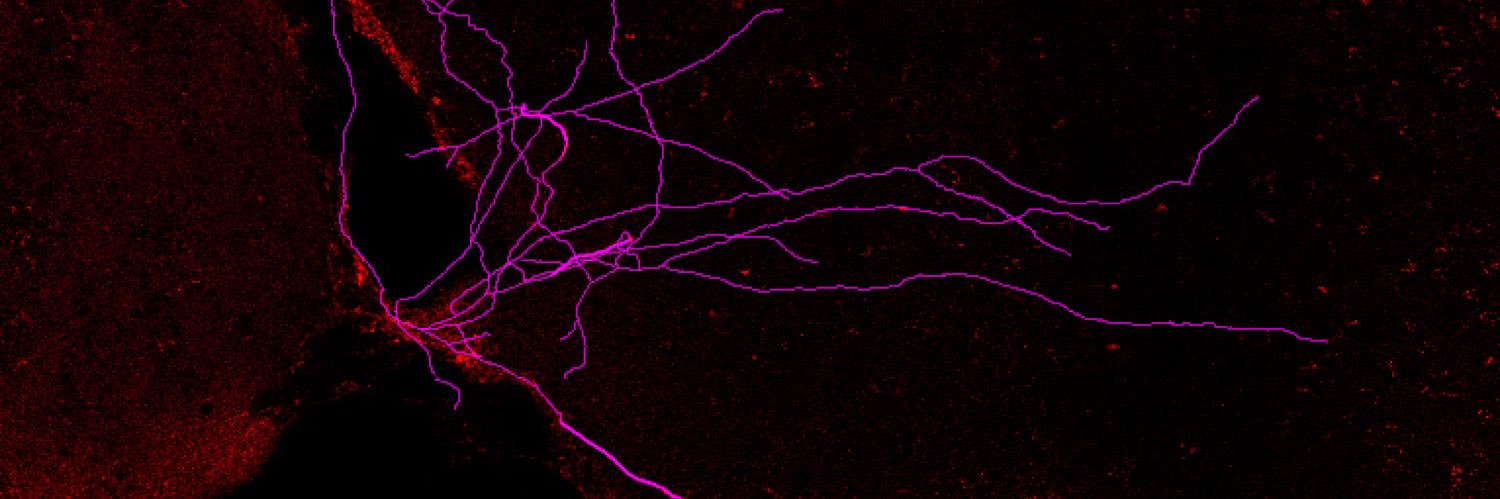 Harris Blankenship banner