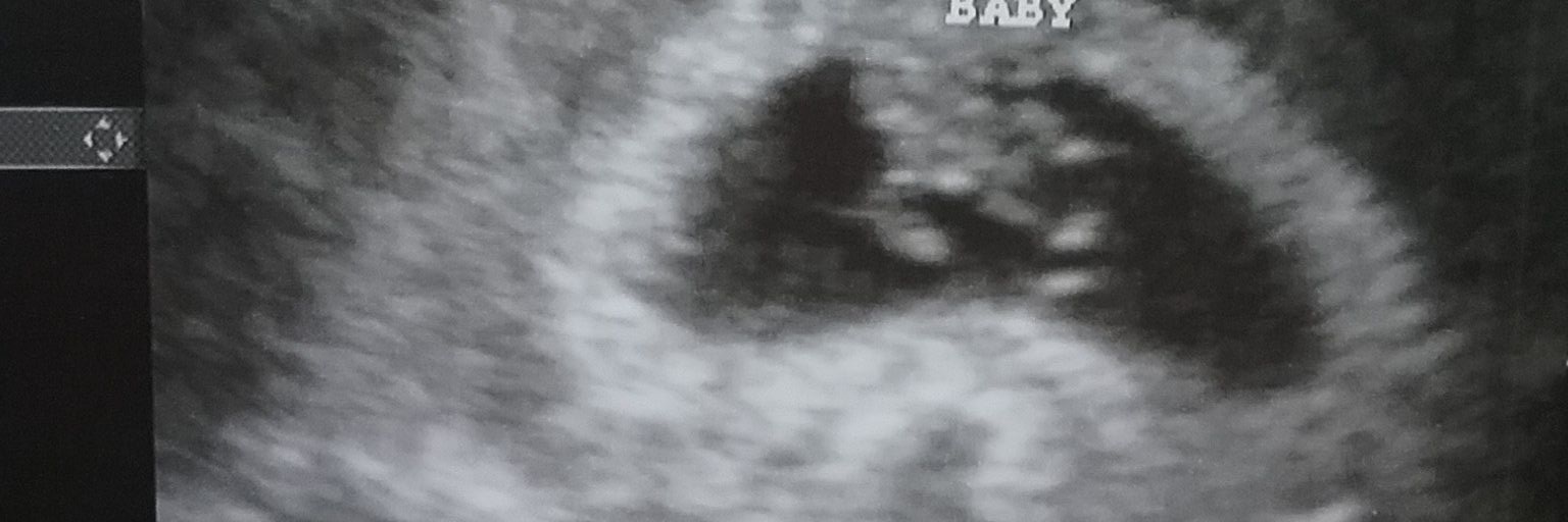 BenthalKayla's profile banner image