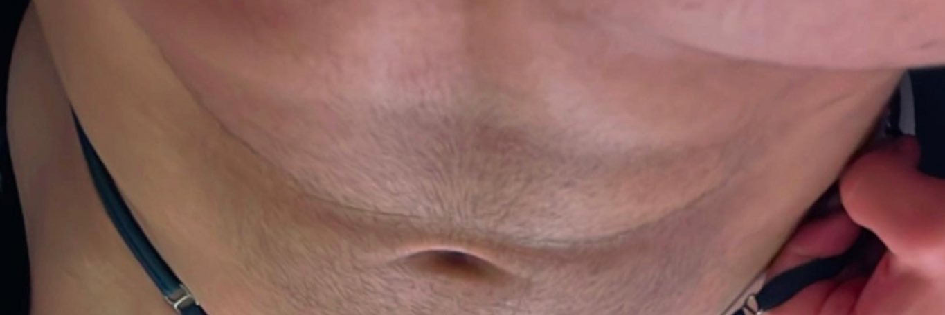 Billy | ⚡️ banner