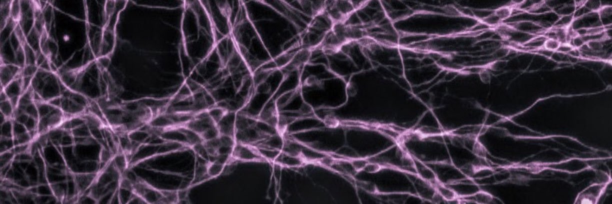 NeuroRaeesa's profile banner image