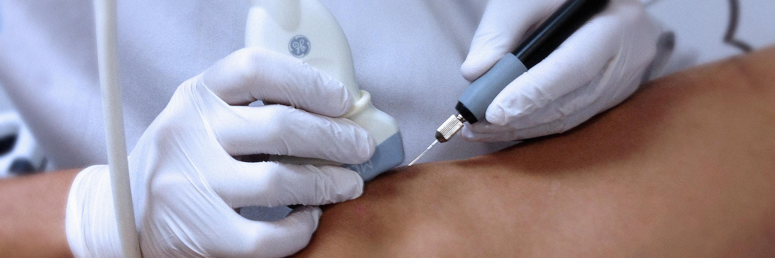 Electr. Percutánea banner