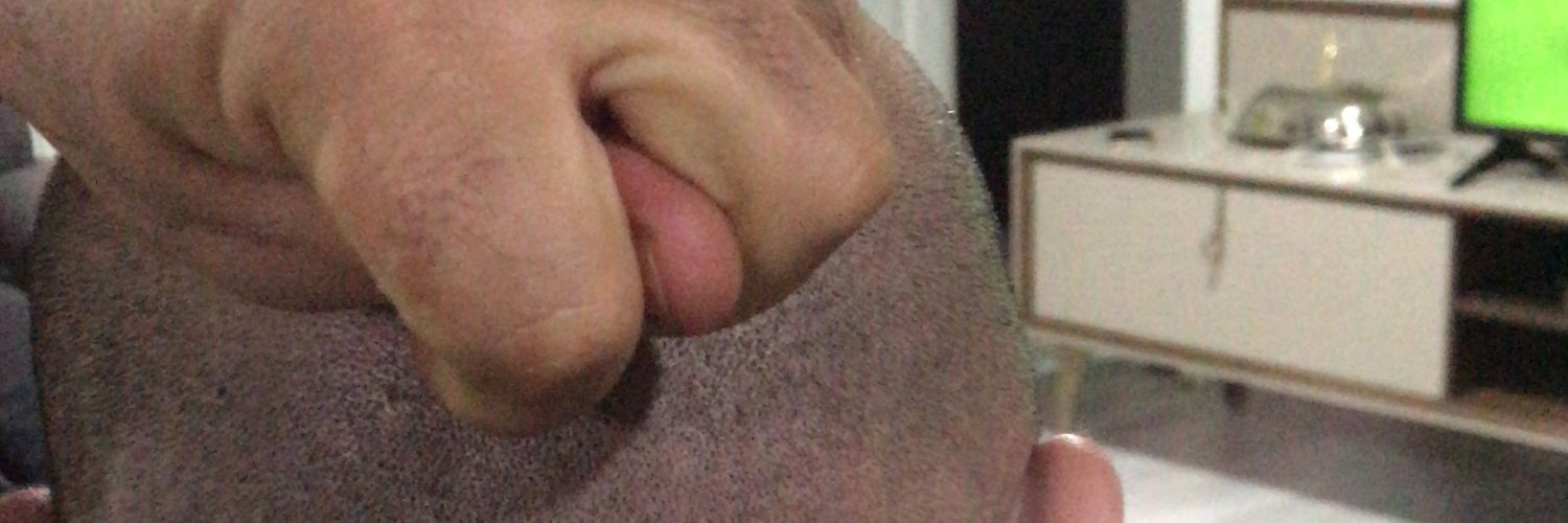 Linçburk Limonata banner