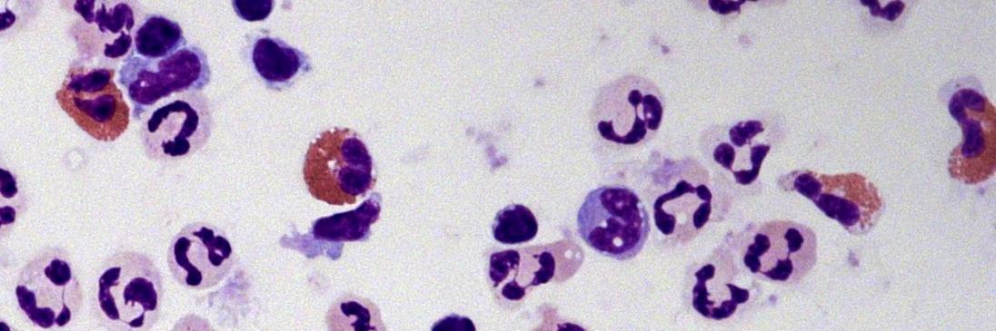 BrainInflammationGrp's banner