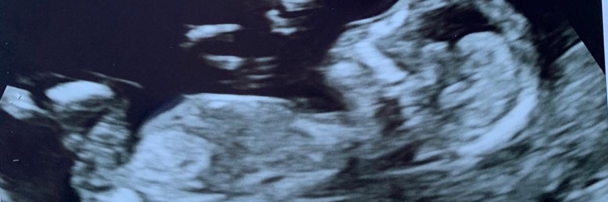 HerdmanMartin's profile banner image