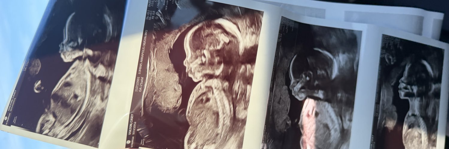 caseyusilton's profile banner image