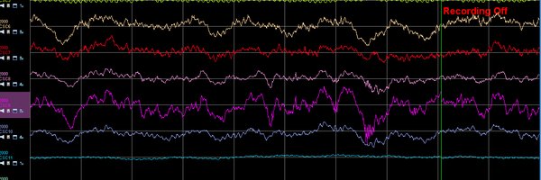 rrritalin Profile Banner