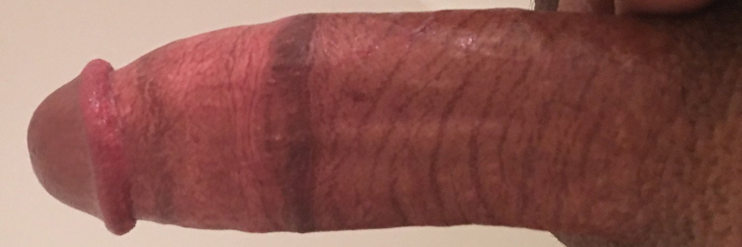 fatvein69's profile banner image
