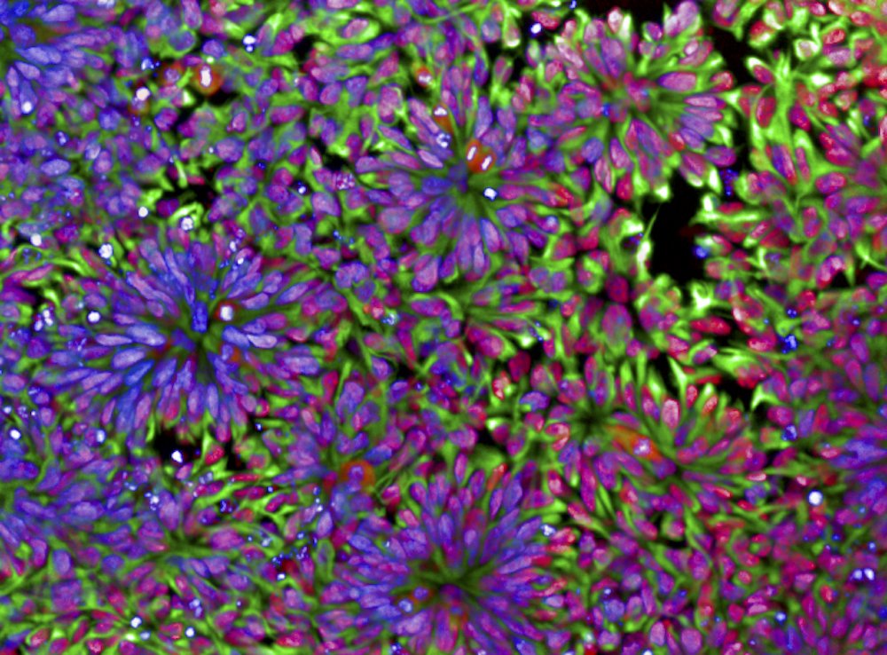 Franzef Müller banner