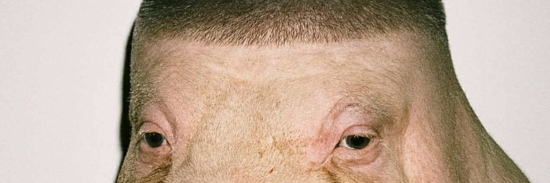 Teddy Champagne banner