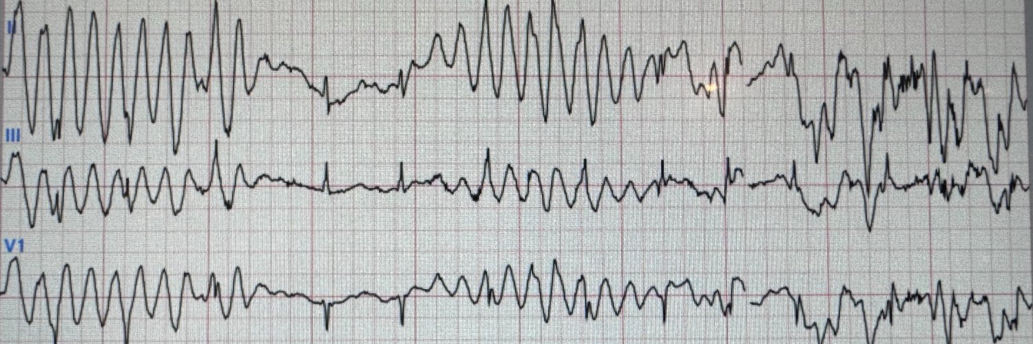 Jason Gencher banner