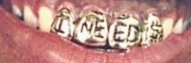➕ itzHIP ➕ banner
