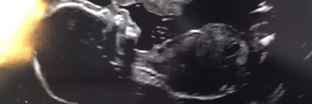 CarlyBeyn's profile banner image
