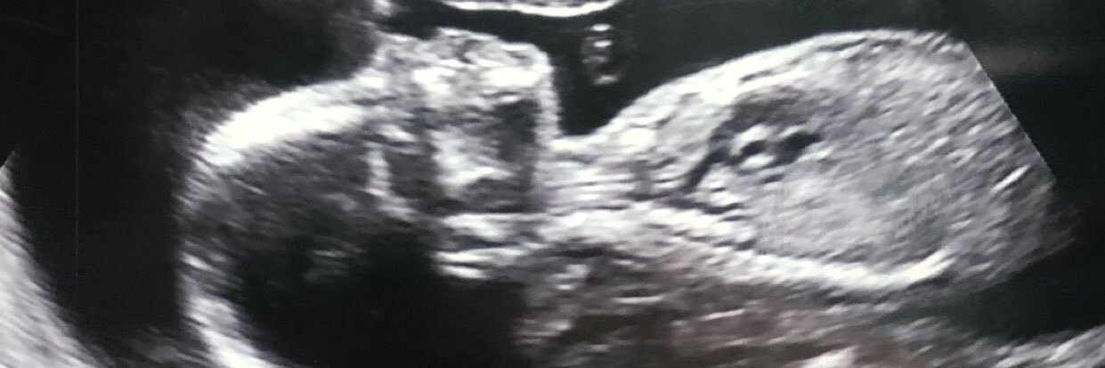 Macy Reigelsperger banner