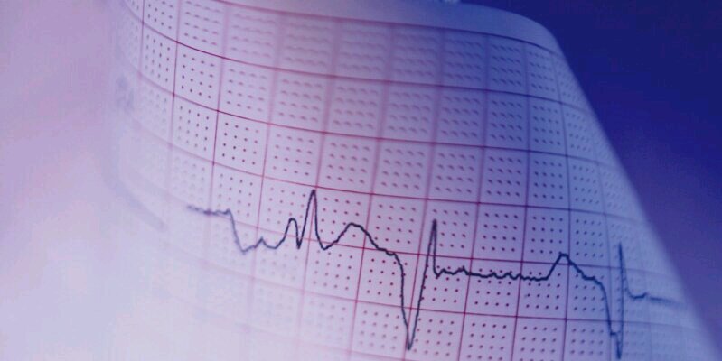 Cardioleaks's profile banner image