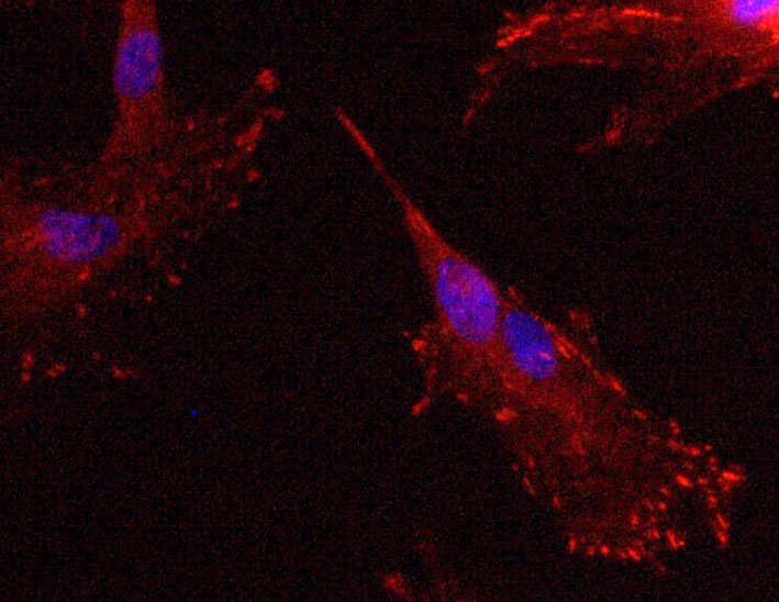 Oscar Martinez banner