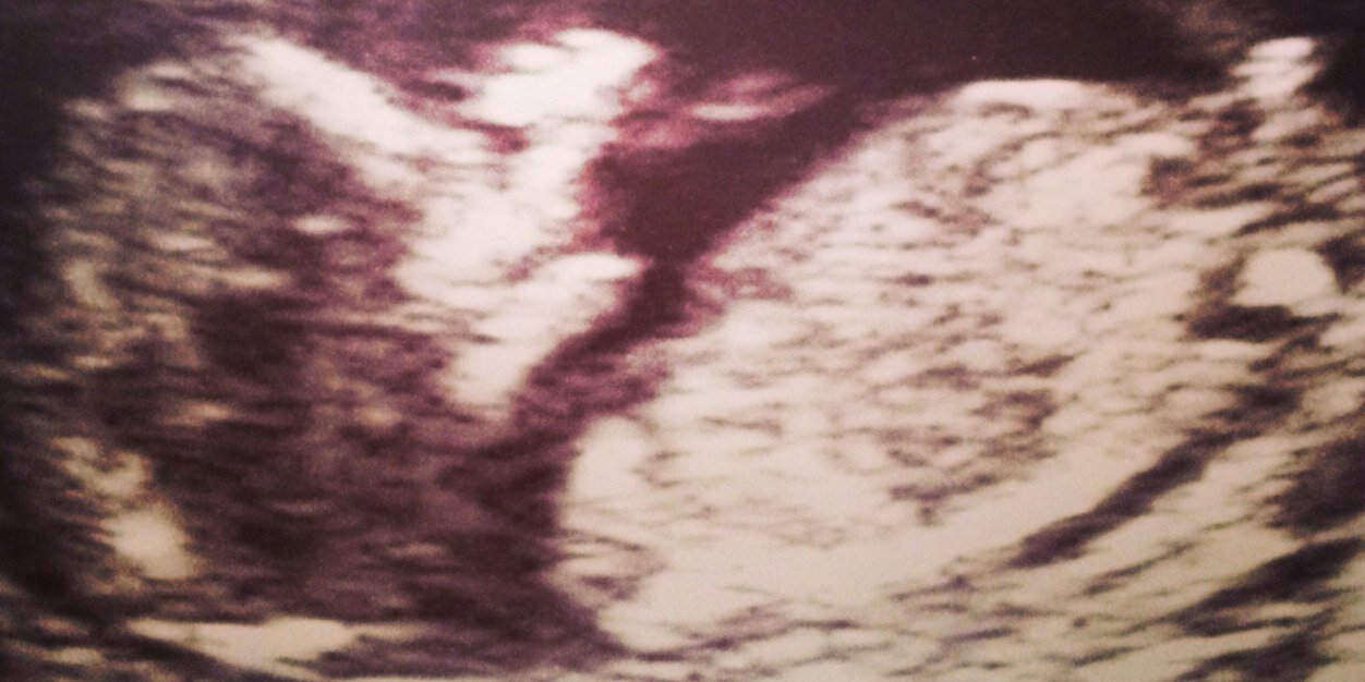 JoshMitchh's profile banner image