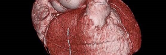 Dustin Thomas, MD, FACC, FSCCT banner