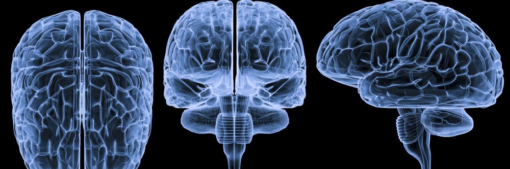 Brain Disorders banner