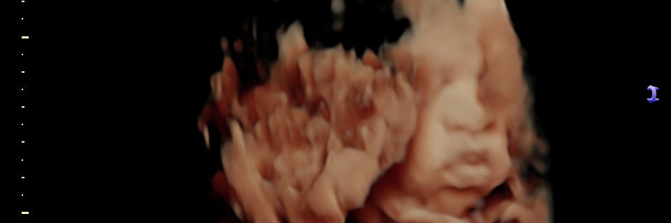 DaBae🍯 banner