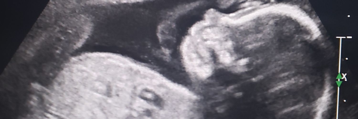 emmagstew's profile banner image
